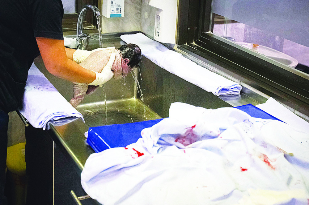 Da li bebe boli sečenje pupčane vrpce?