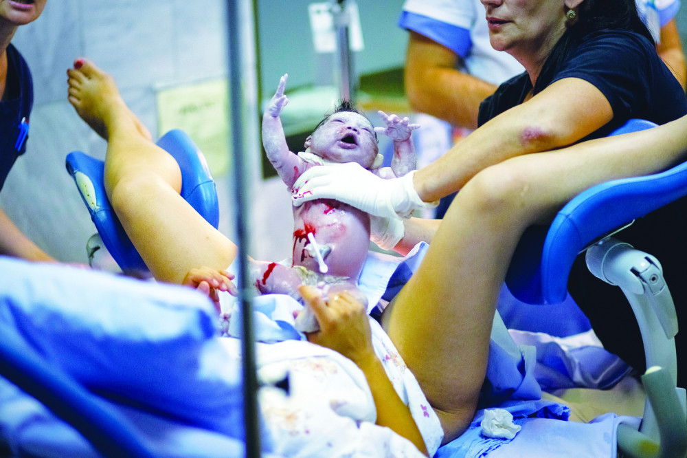 Za 11 meseci potrošili epidurala kao za 15 godina!