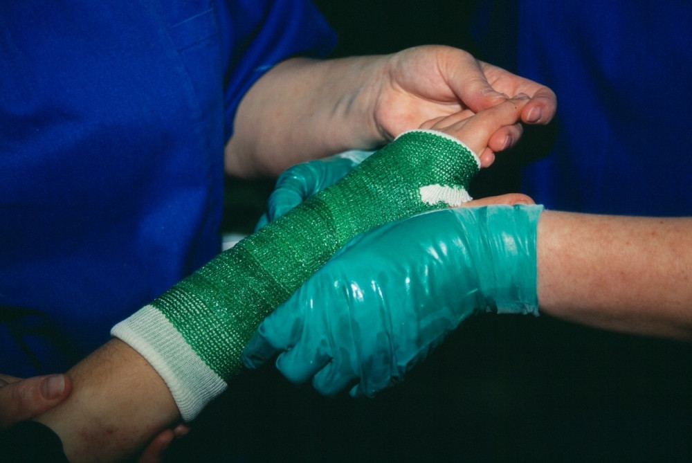 Kako je od preloma ruke došlo do sepse!