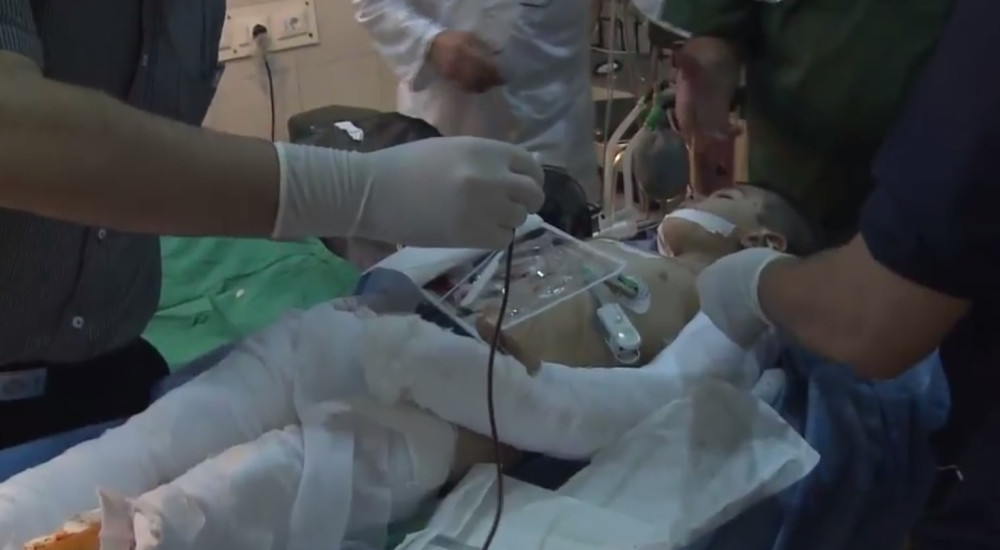 Granatirali decu u Alepu