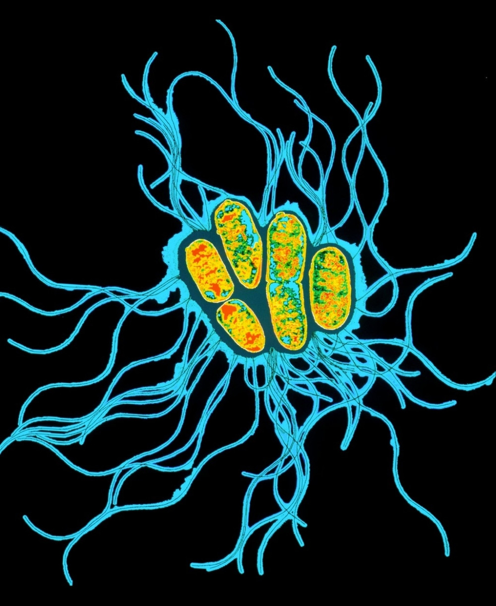Ovo su najopasnije bakterije na svetu!