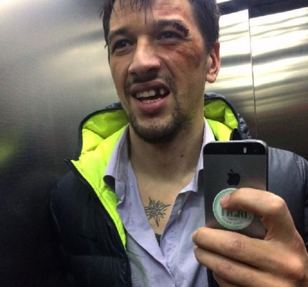 Viktor: Pretukli su me jer sam gej!