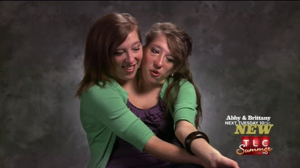 Kako se seksaju sijamski blizanci?! (VIDEO)