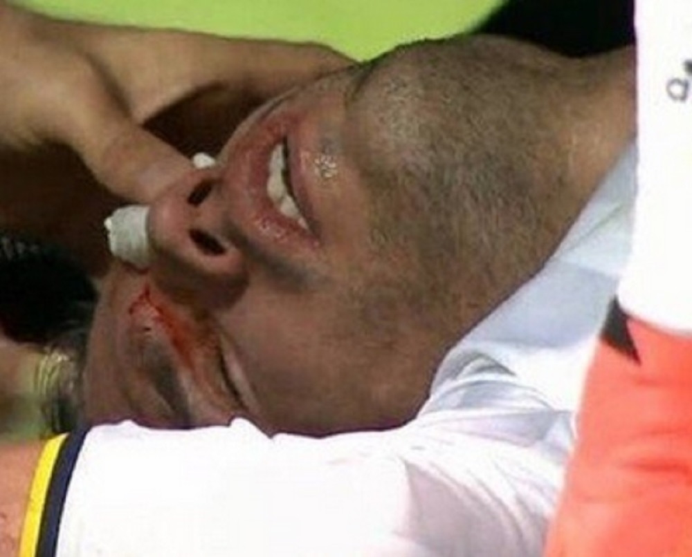 Van Persi umalo ostao bez oka (VIDEO)