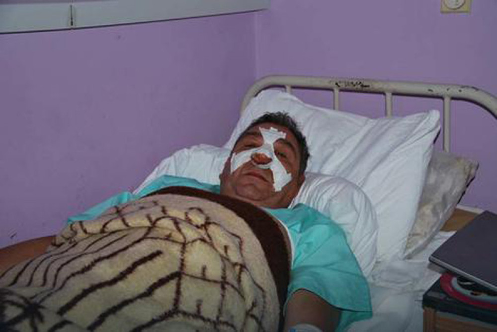 Udarao me dok sam ležao u lokvi krvi