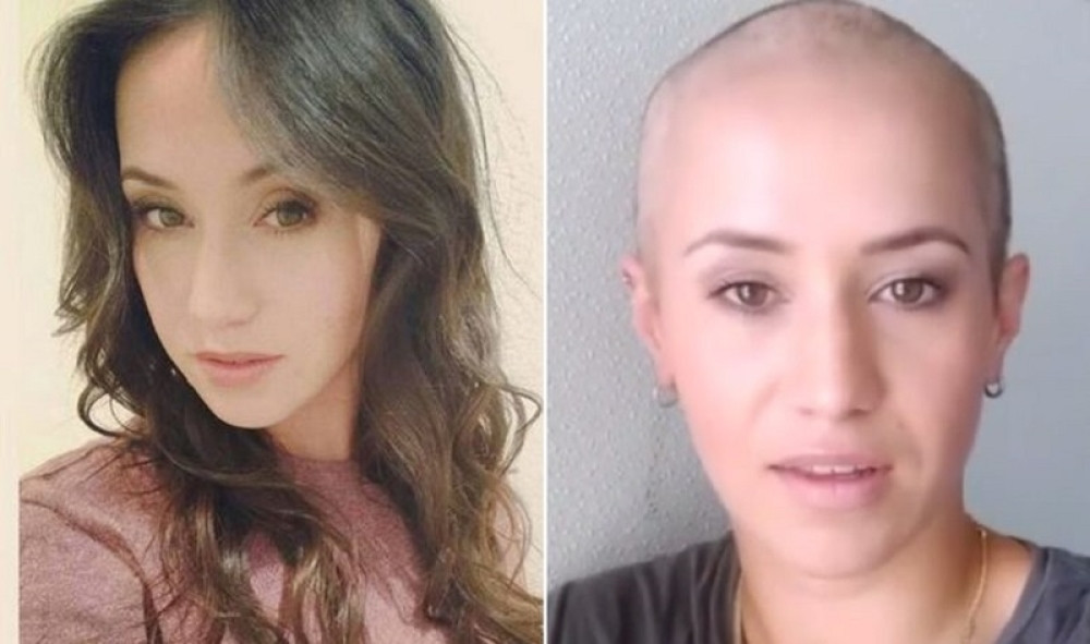 Žrtvi silovanja opala kosa zbog stresa (VIDEO)