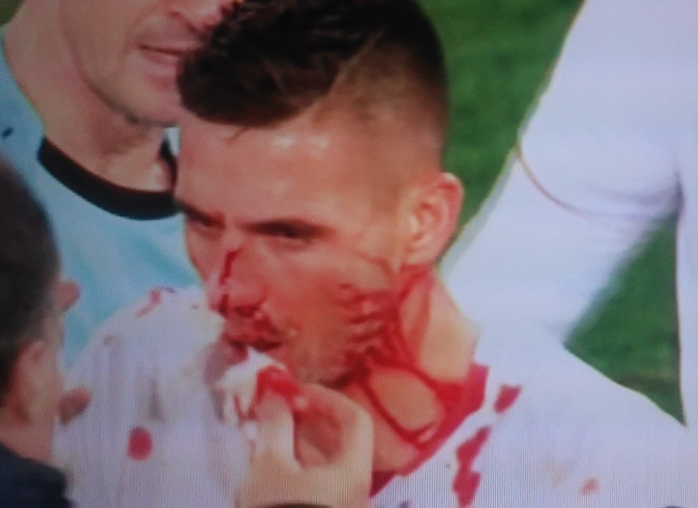 Evo šta je Tejlor uradio Tadiću! (UZNEMIRUJUĆI FOTO)