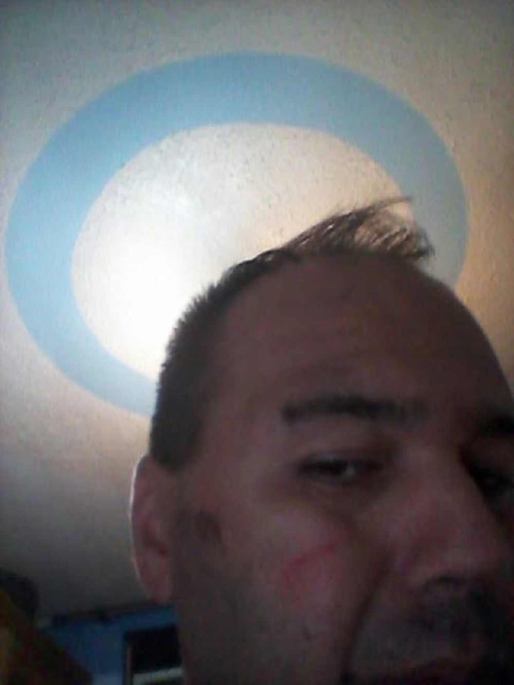 Osoblje premlatilo pacijenta u Novom Sadu?!