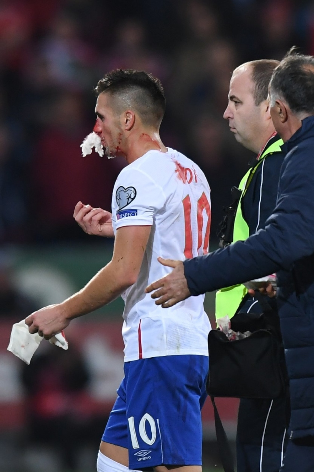 Tadić mora na operaciju!