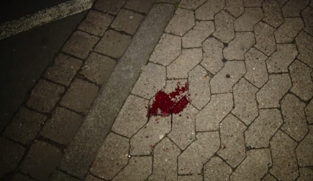 Umesto znoja, devojci sa lica kaplje krv (FOTO)