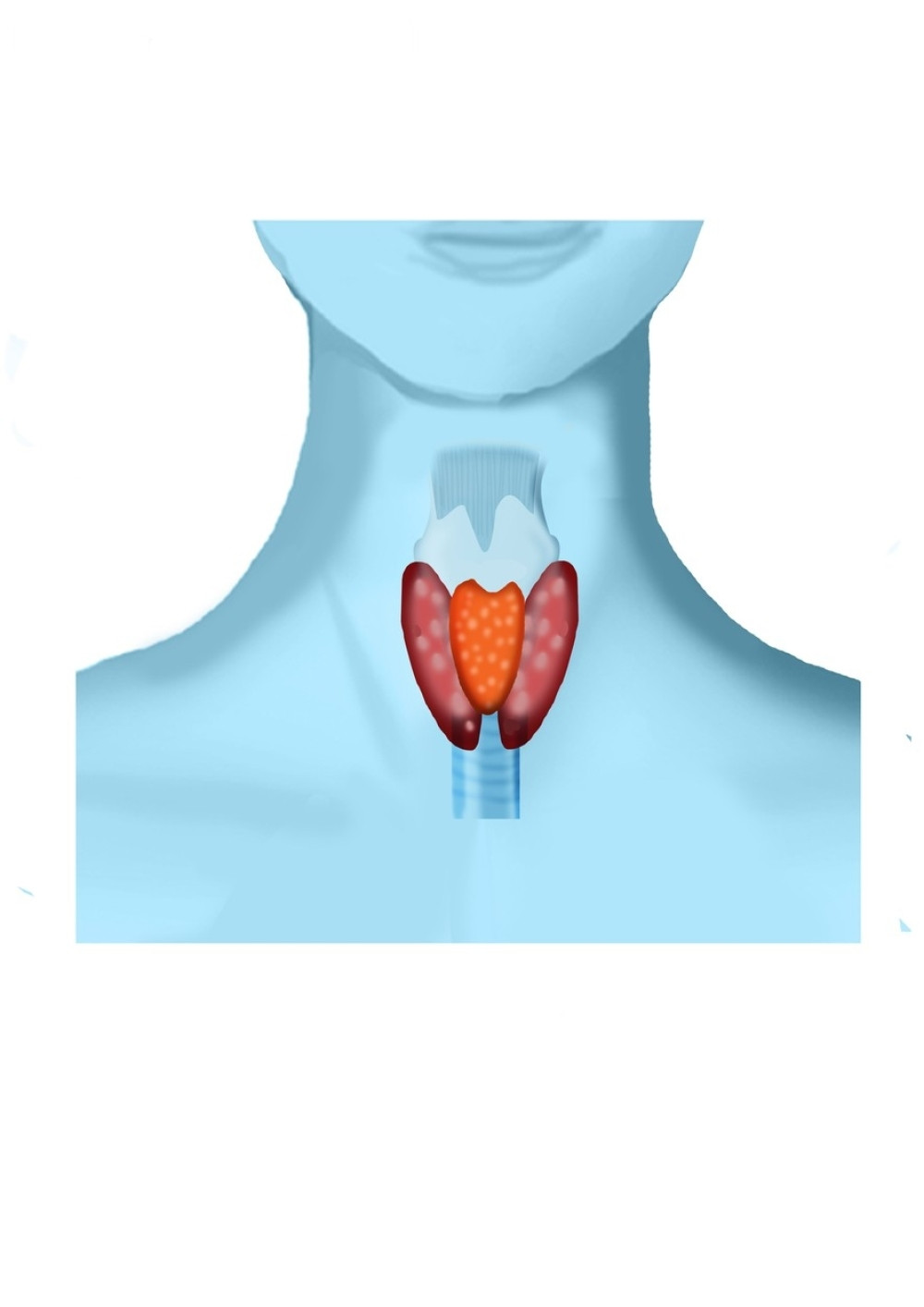 Simptomi bolesne štitne žlezde