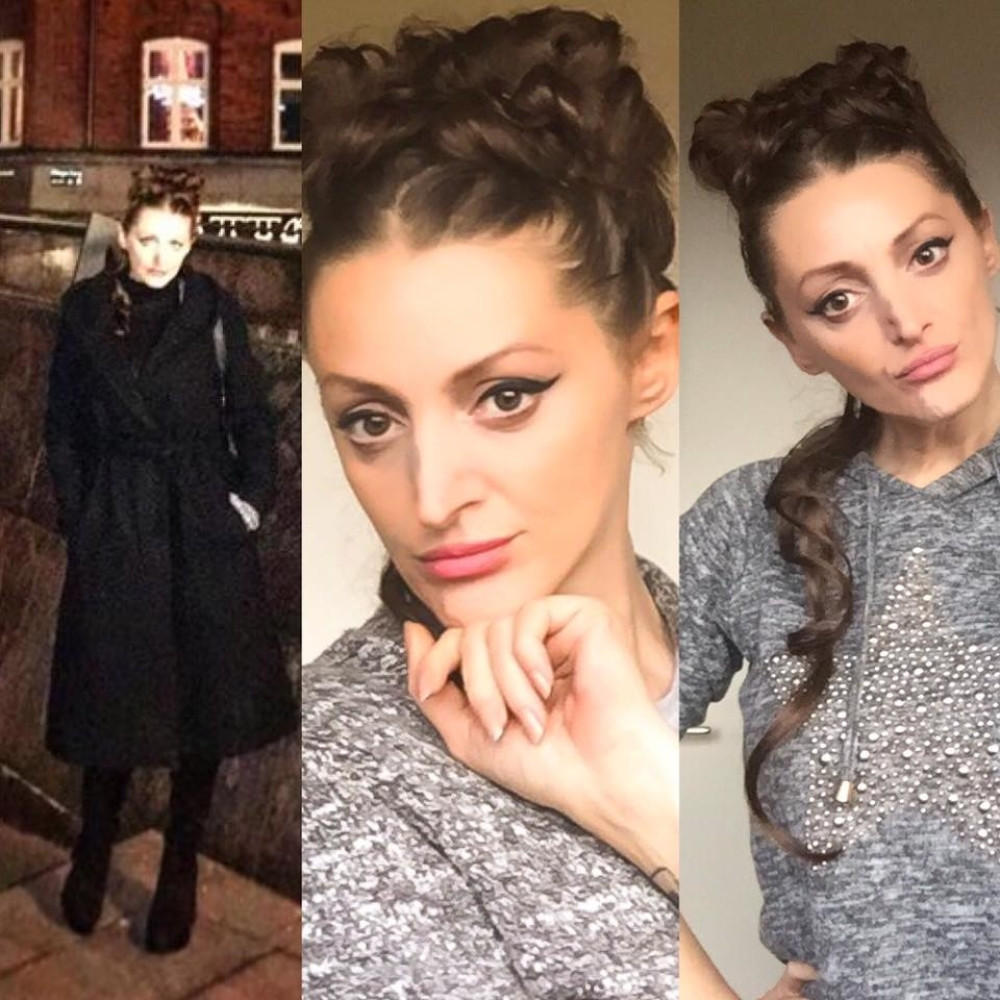 Oporavak predugo traje