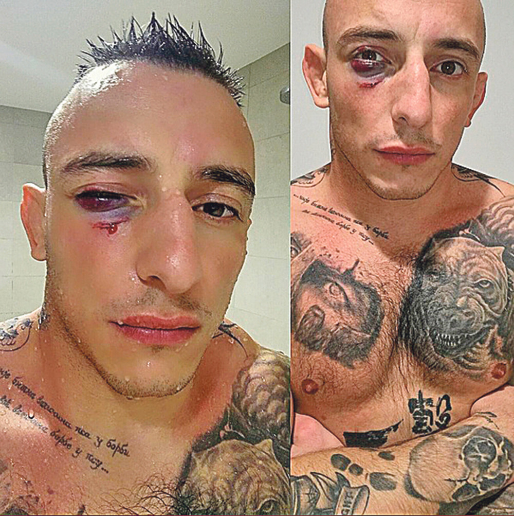 Moram na pauzu da ne bih oslepeo!