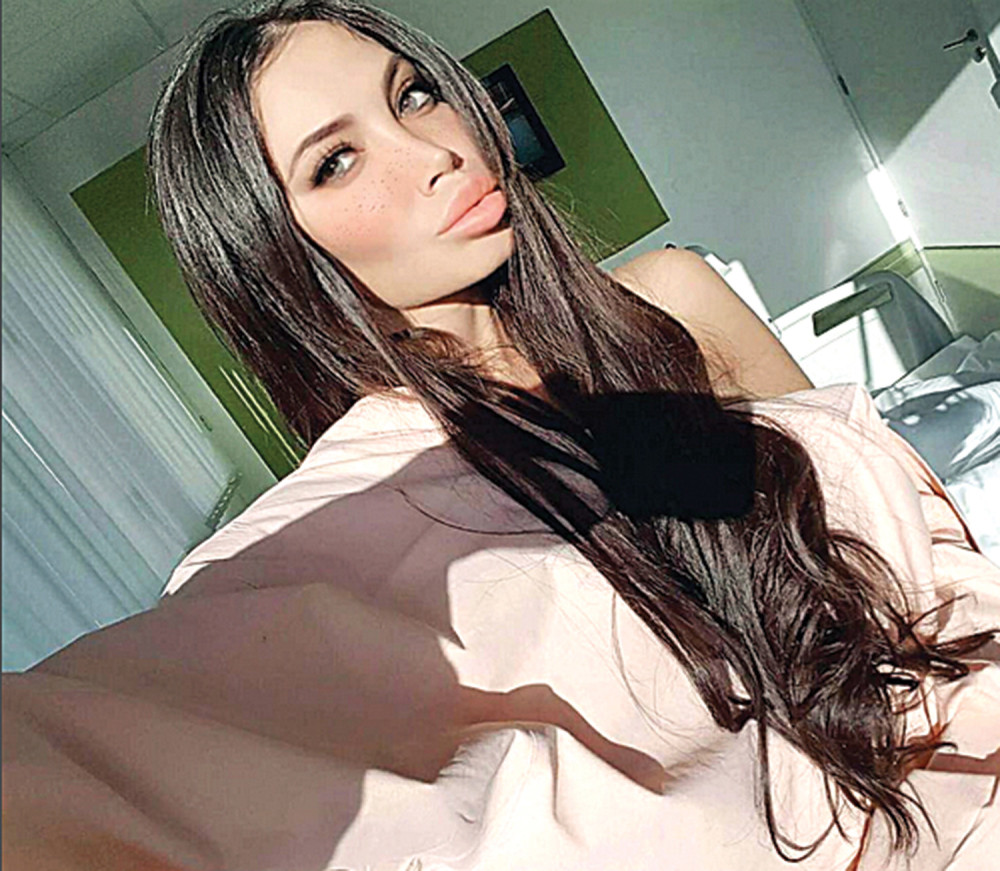 Soraja zbog zdravlja smanjila grudi!