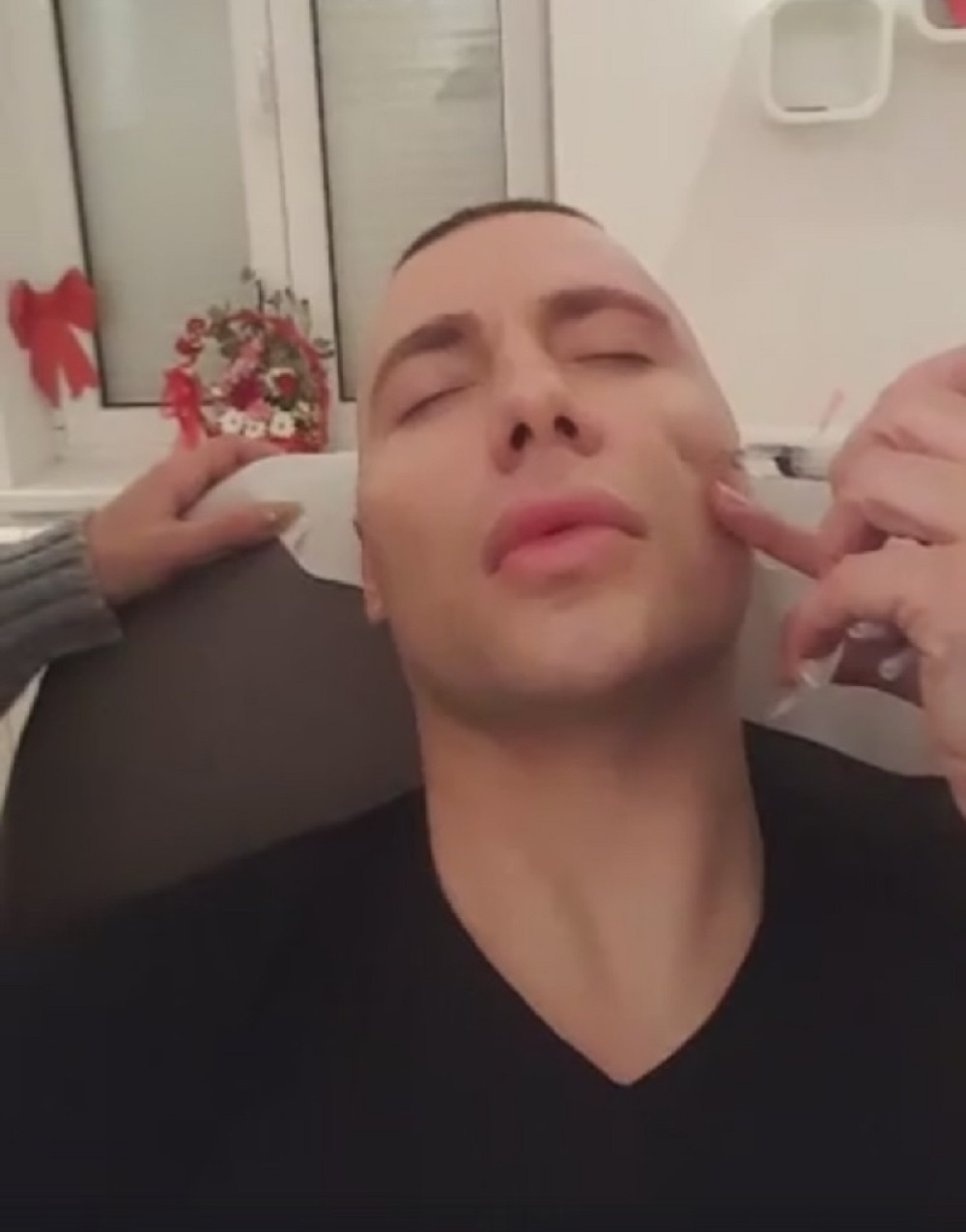 BRENDONU IZDEFORMISANO LICE! Fanovi besni zbog plastičnih operacija koje je uradio pred ulazak ZADRUGU! (FOTO)