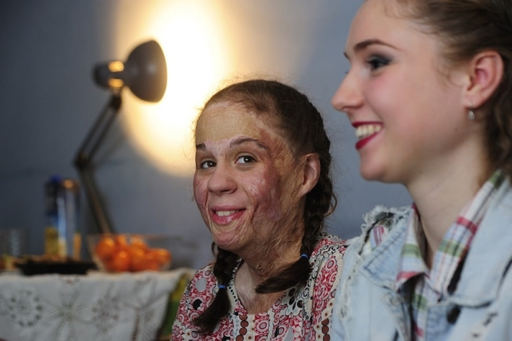 Hrabra Vasilisa (13) bije životnu bitku! (FOTO)