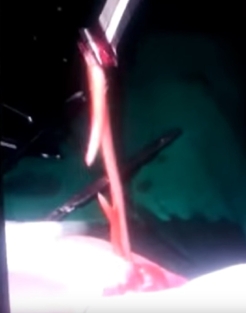 Nećete verovati šta su našli u stomaku pacijenta (VIDEO)