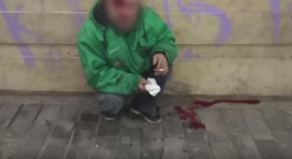 Prosjak brutalno pretučen na Zelenjaku! (VIDEO)