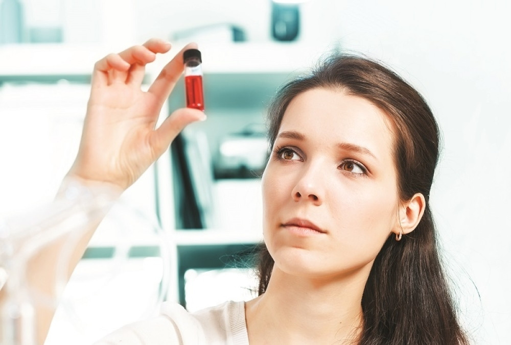 Možda vam fali vitamin B12!