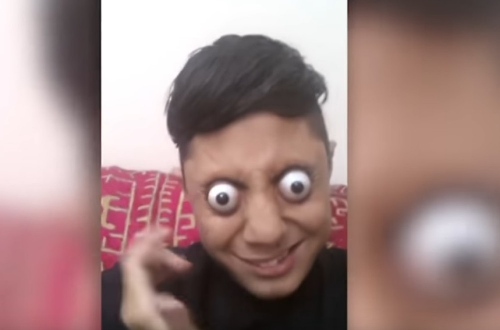 Oči koje iskaču! (VIDEO)