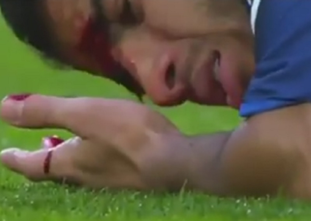 UZNEMIRUJUĆE~Horor povreda Rafinje (FOTO+VIDEO)