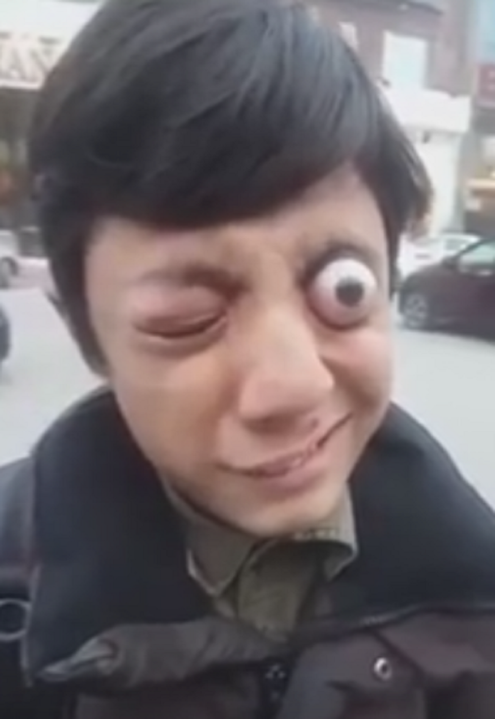 Dečak može da izbaci oči čitav centimetar! (VIDEO)