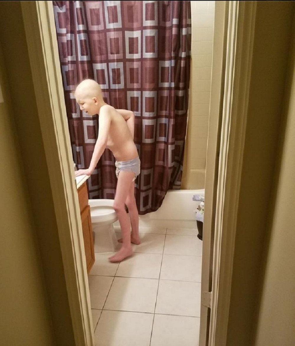 Ovo je moj sin, bolestan od raka