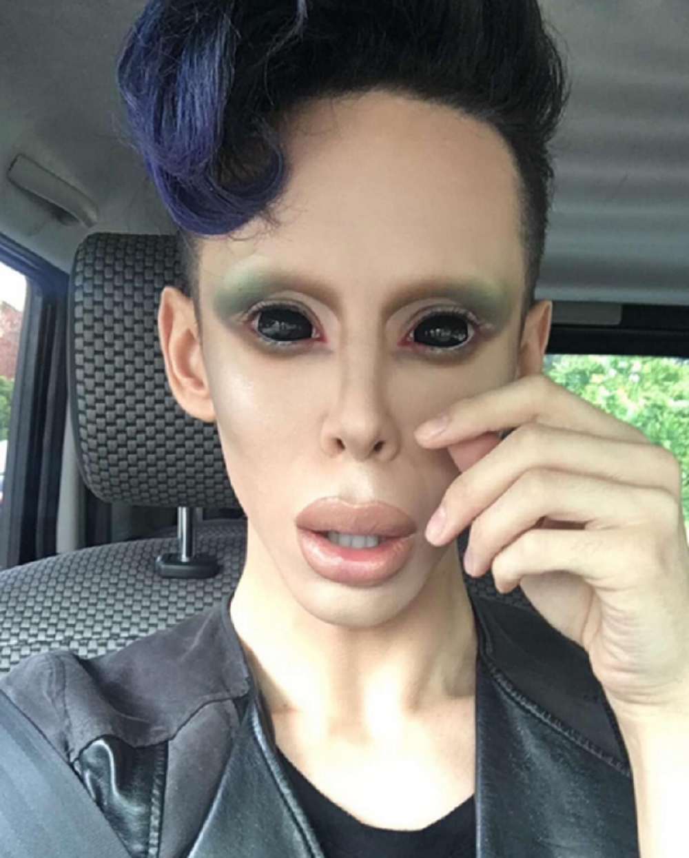 Operisao se 110 puta da liči na vanzemaljca! (FOTO)