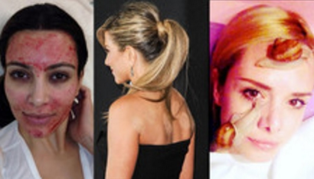 Najbizarniji tretmani poznatih dama (VIDEO)