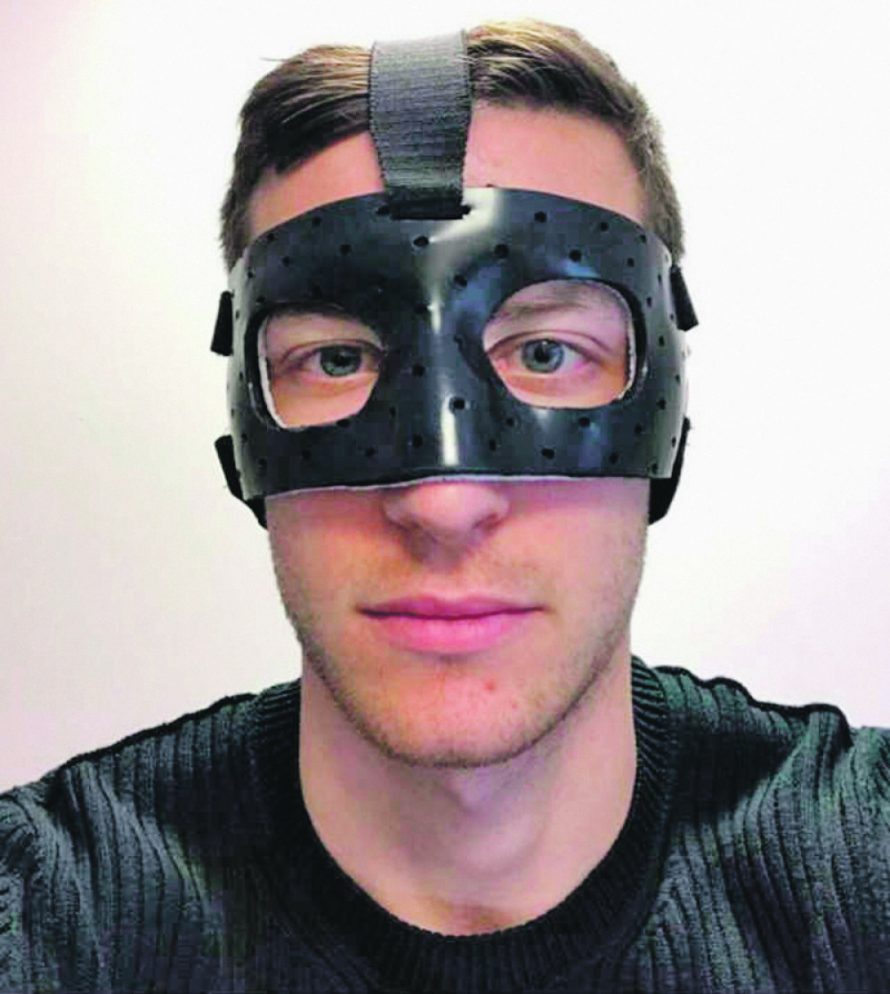 Uroš Spajić polomio nos!