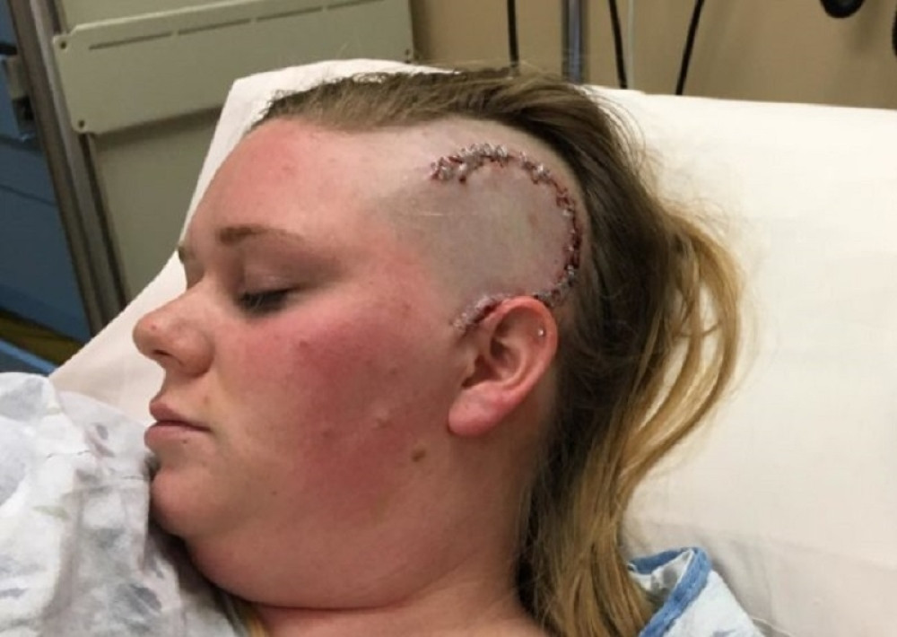 Preživela tešku nesreću, dobila anđela čuvara (VIDEO)