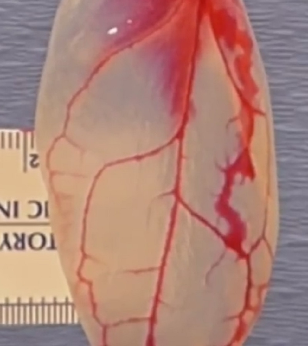 List spanaća pretvorili u srčano tkivo! (VIDEO)