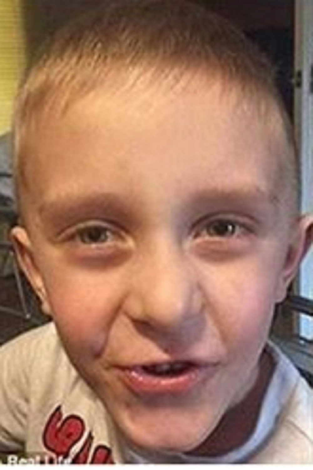 Umro dečak koji je želeo da ga sahrane uz majku