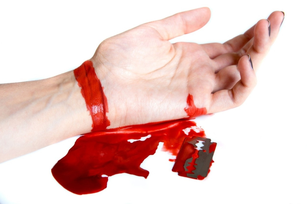 Majka i ćerka isekle vene!