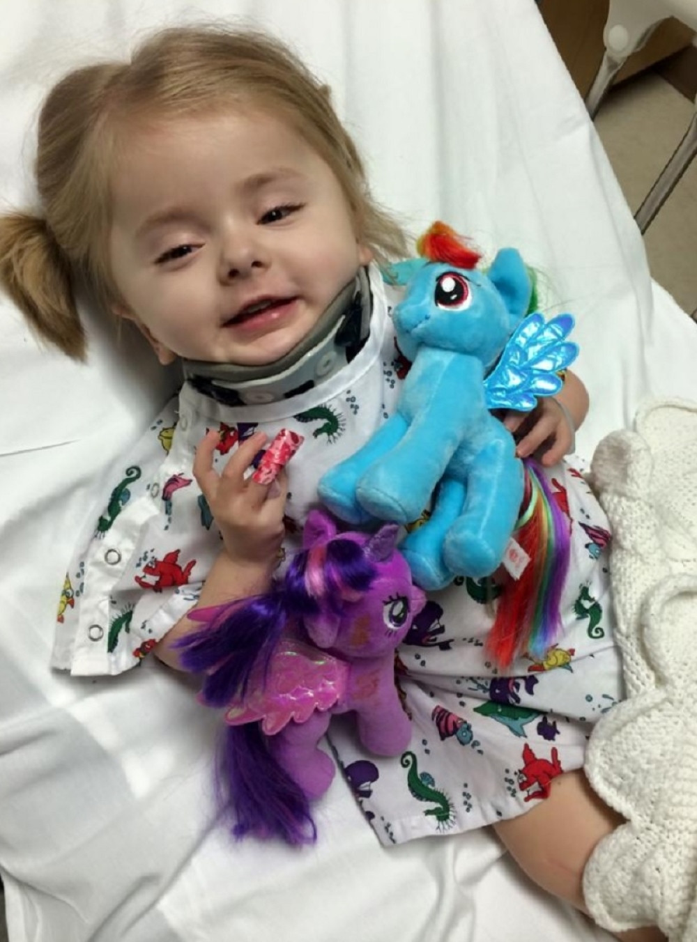 Ova beba boluje od stravične retke bolesti! (VIDEO)