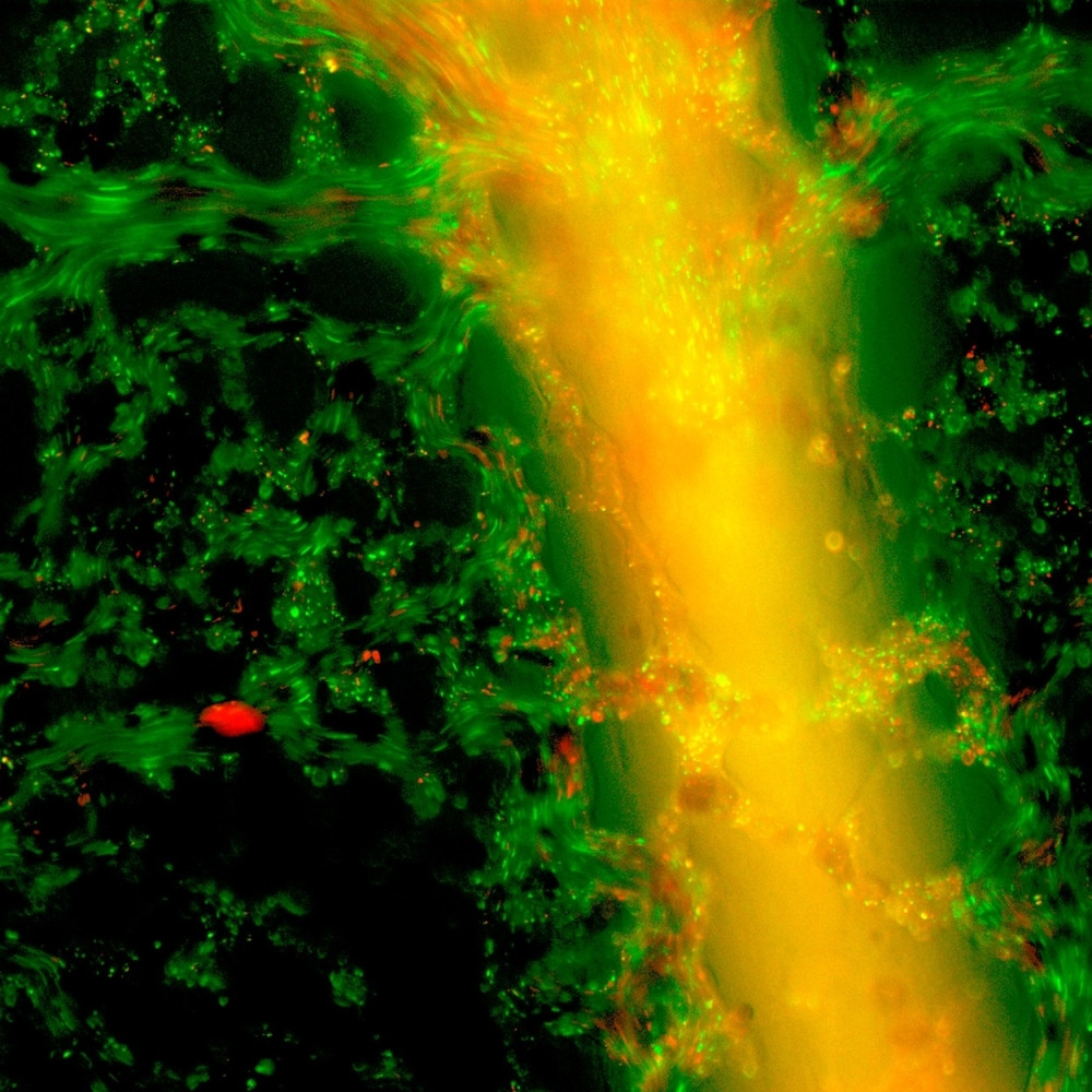 Čudesno otkriće u borbi protiv raka!