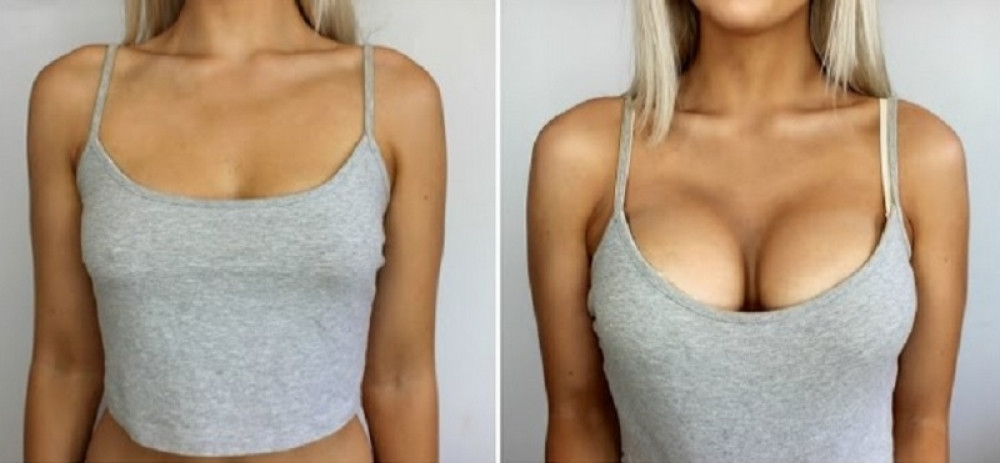 Srbin osmislio grudnjak koji uvećava grudi za samo sedam dana, sve je moguće! (FOTO+VIDEO)