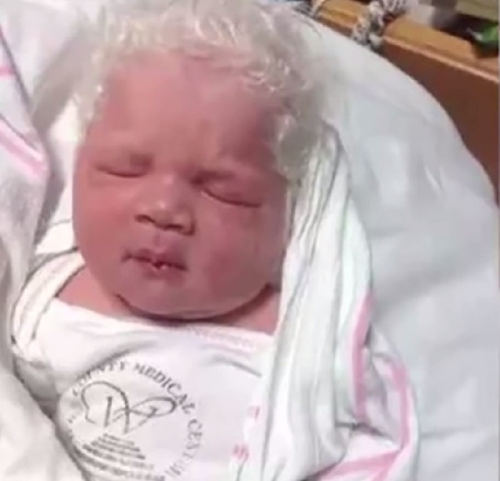 Beba rođena skroz seda (VIDEO)