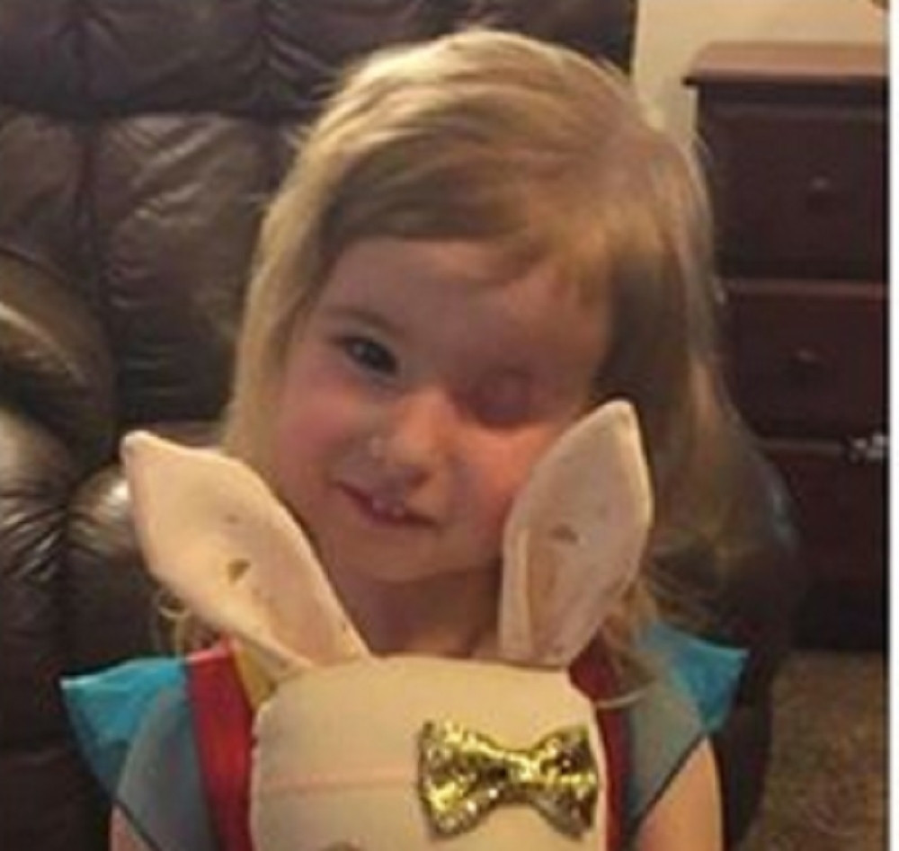 Izgubila je oko zbog raka, a njena mama je uradila ovo