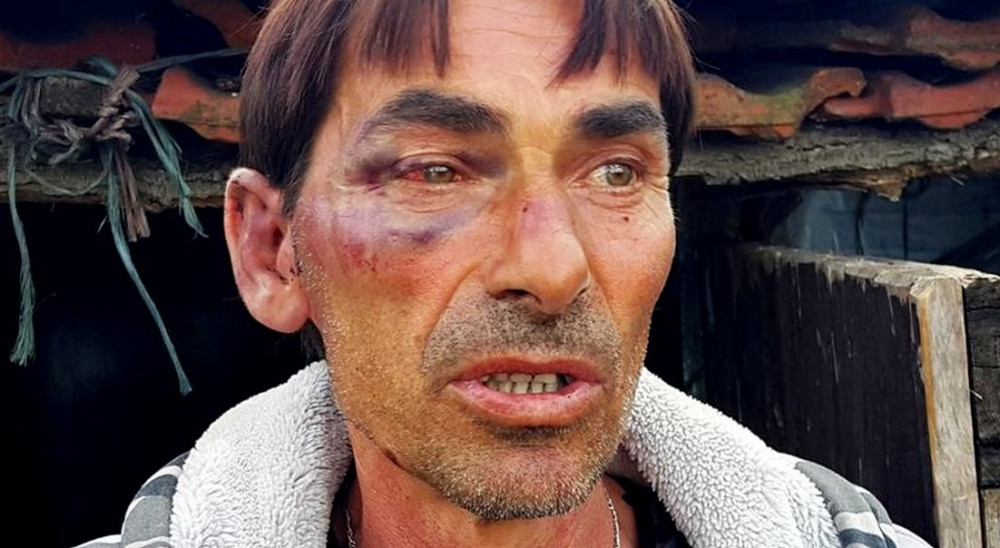 Pretukli čobana, vezali ga i ukrali stado ovaca! (FOTO)