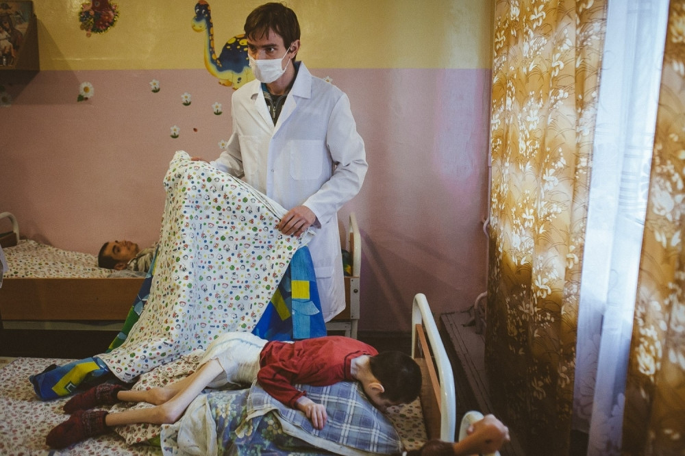 Noge su im kao čačkalice, presvučene kožom (UZNEMIRUJUĆI FOTO)