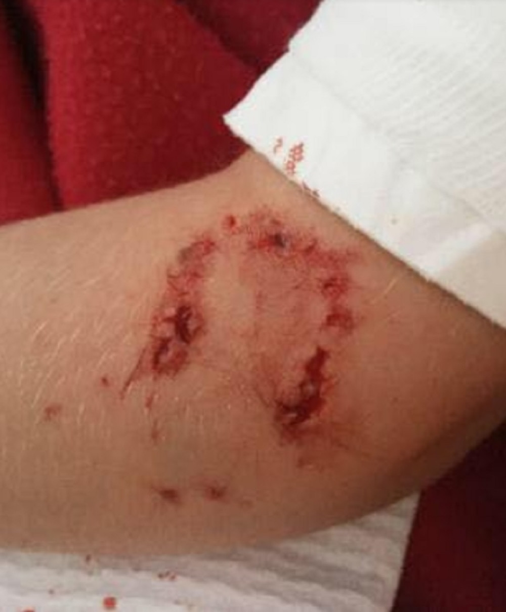 Ljubimac ujeo Vojvođanina, strahuje se od posledica, nećete moći da verujete šta je držao u stanu