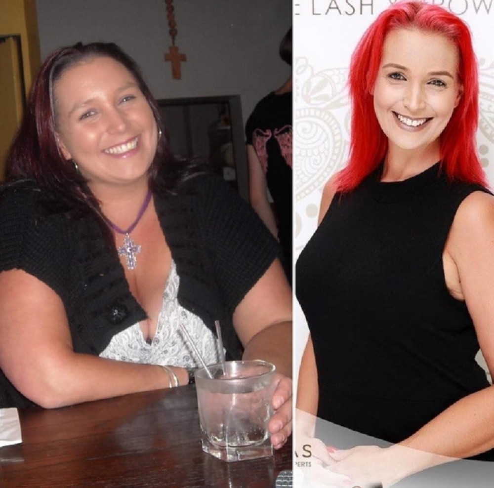 Smršala 70 kilograma jer je izbacila ove namirnice! (FOTO)