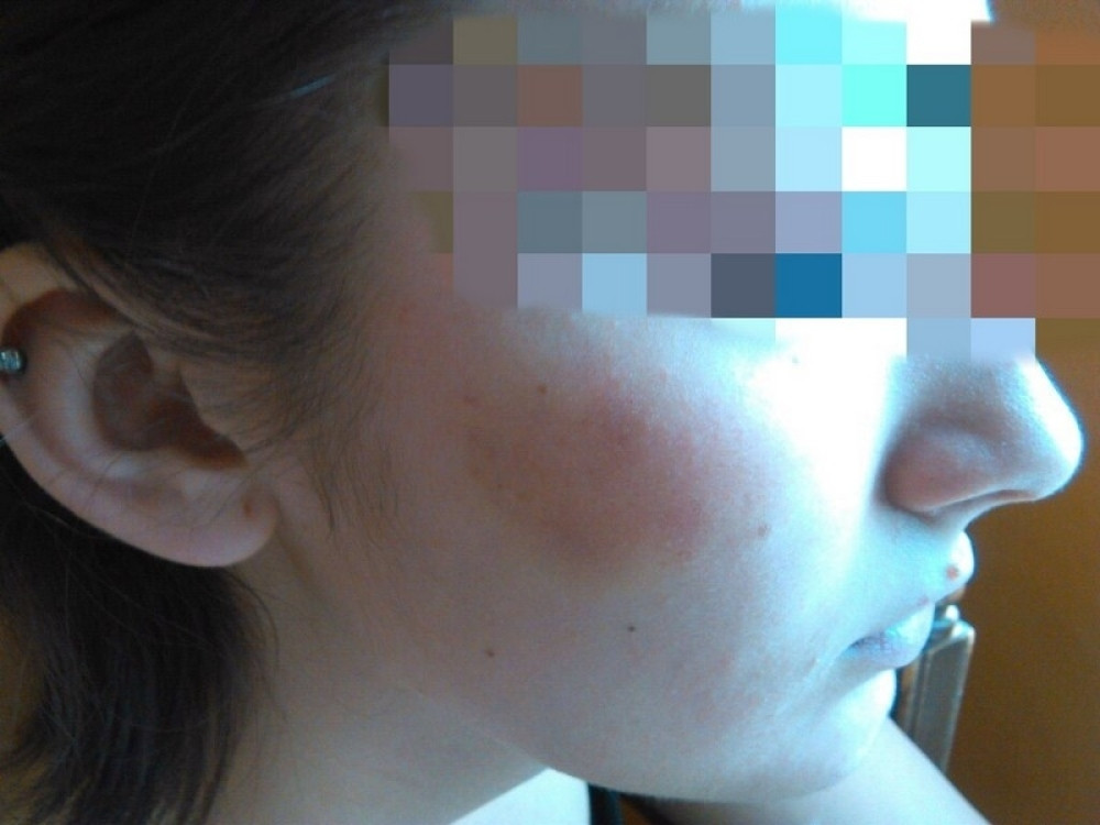 Pet devojčica brutalno tuklo vršnjakinju, niko da pomogne!