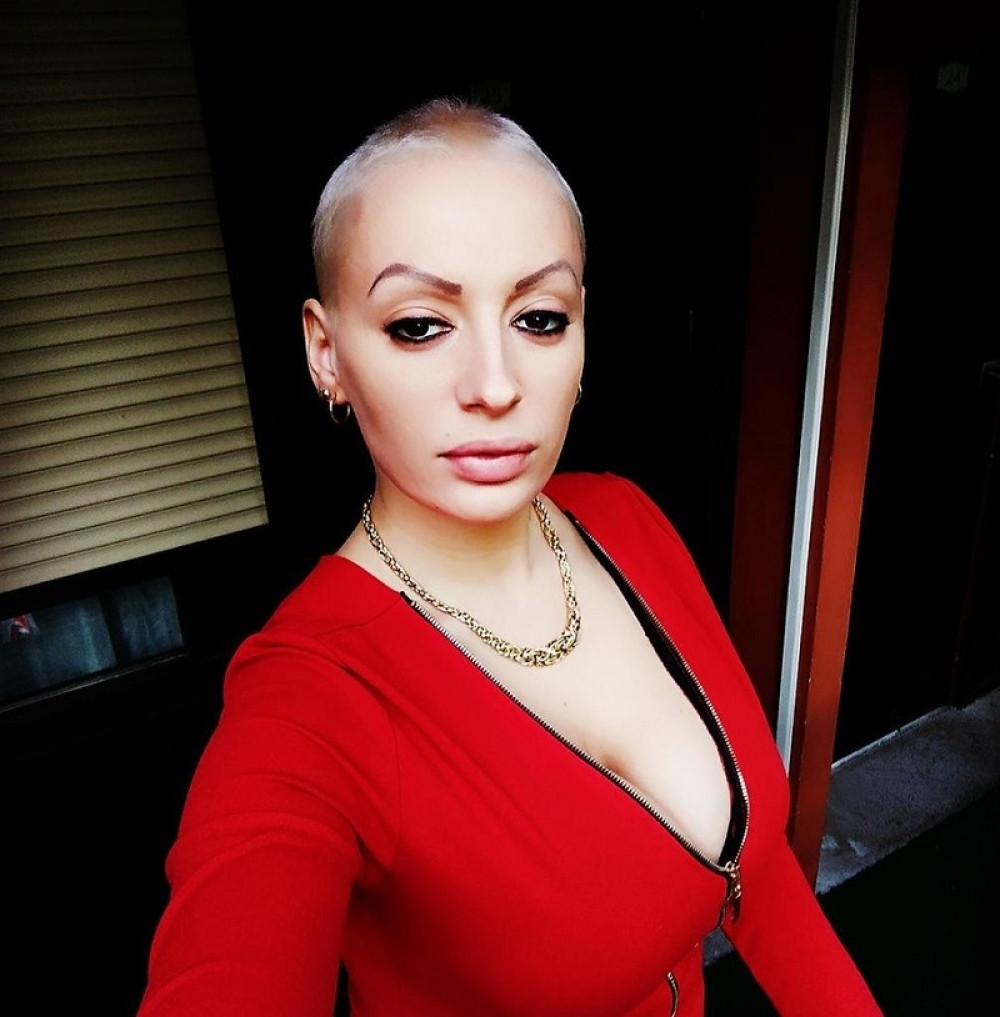 Nevena Hot se oglasila nakon pokušaja samoubistva! Otkrila stravične detalje!