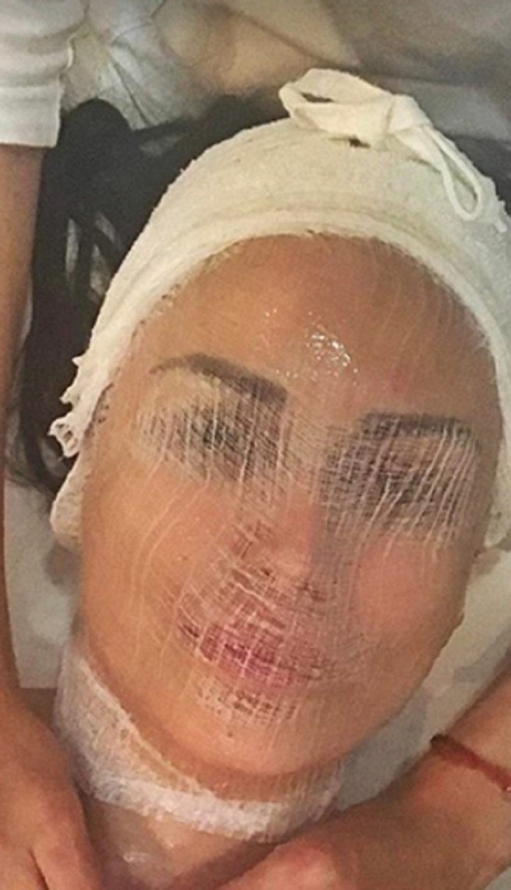 Pevačica završila u zavojima!