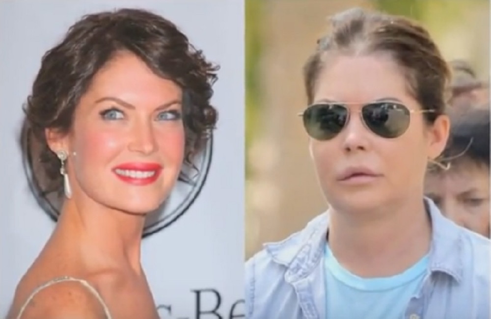 Bila je seks simbol 90-ih, a onda se uništila estetskim operacijama (FOTO)