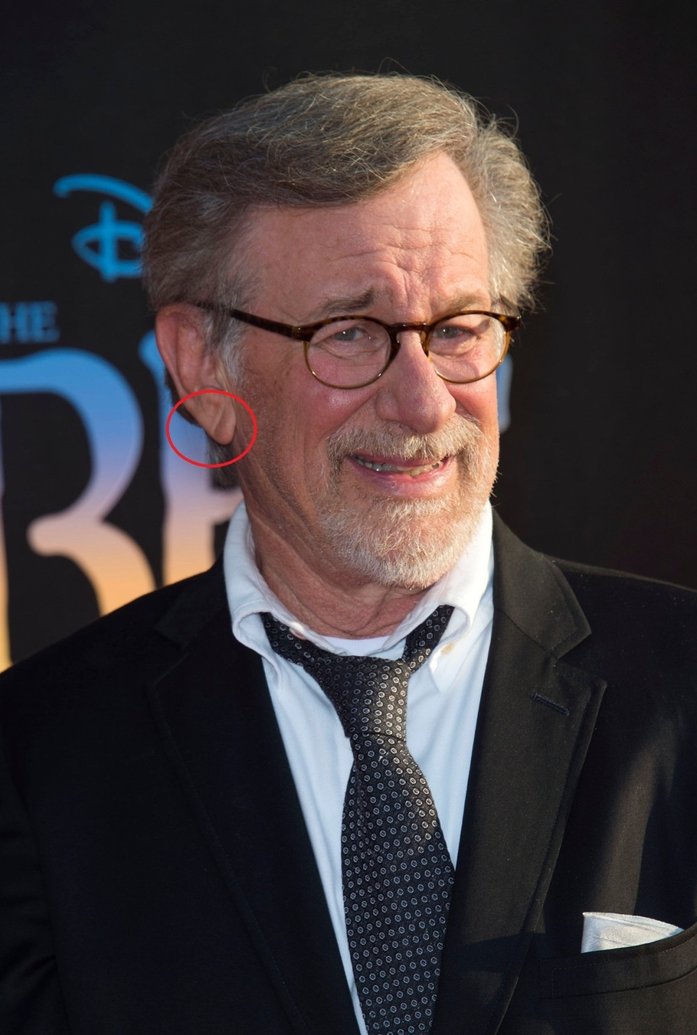 Da li imate Frankov znak na ušnoj resici?