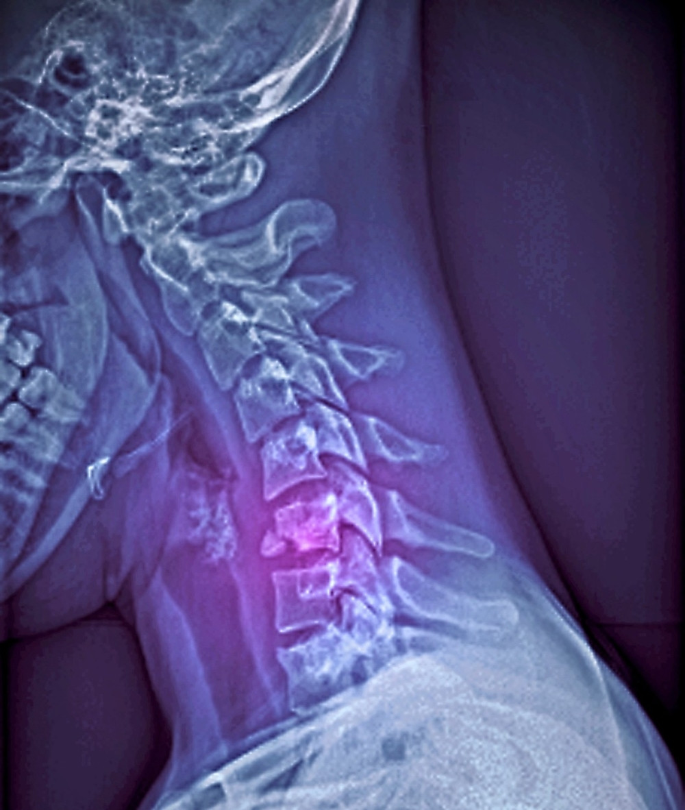 Učenik slomio vrat na ekskurziji