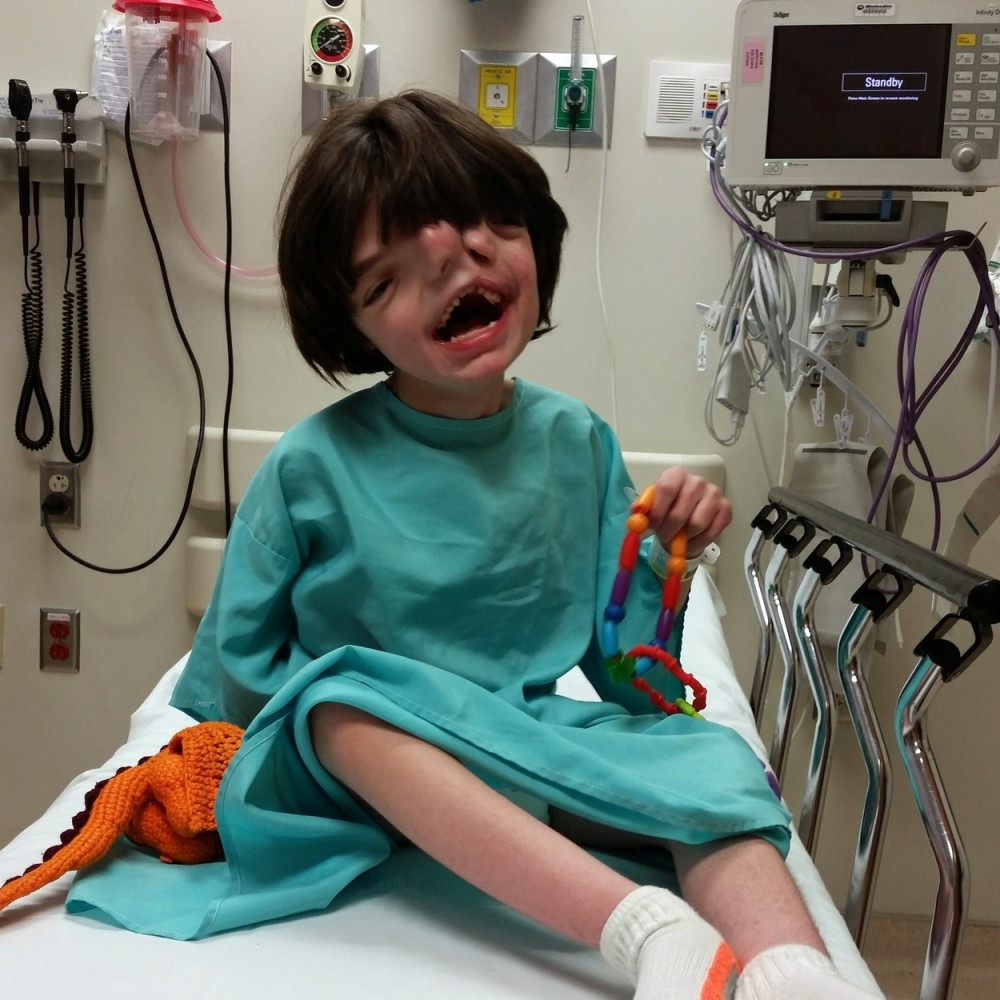 Dečak sa dva lica proslavio 13. rođendan (FOTO)